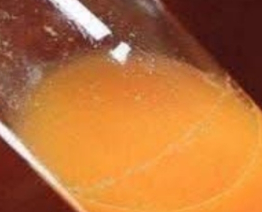 Screenshot 2025 03 21 20 10 31 928 com.brave .browser edit