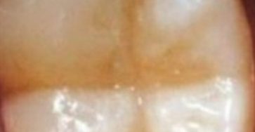 Screenshot 20250326 233417 Brave 768x409