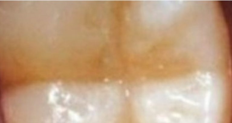 Screenshot 20250326 233417 Brave 768x409